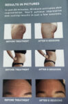 Emerald Medical Aesthetics Winback Treatments Emerald Medical Aesthetics Winback Treatments